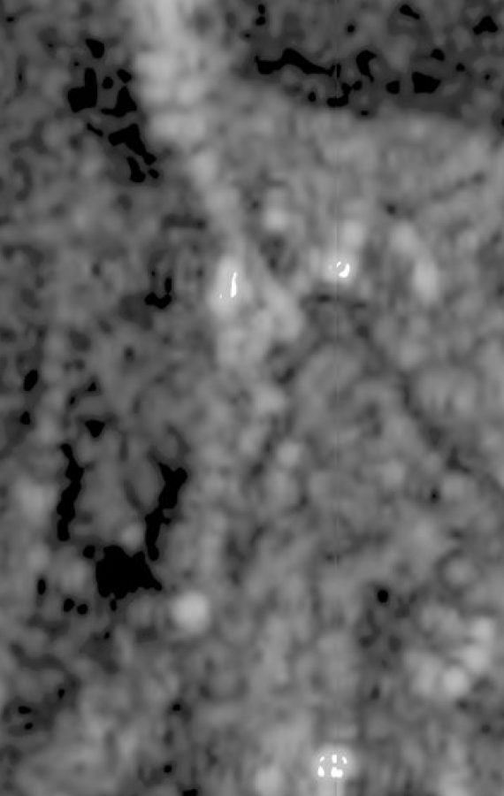 2m Super-resolution